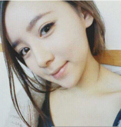 上海時光整形醫(yī)生何晉龍做假體隆鼻效果怎么樣？附案例效果對比圖