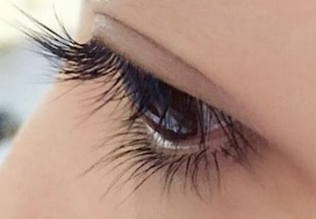 海南華美醫(yī)學(xué)美容醫(yī)院雙眼皮