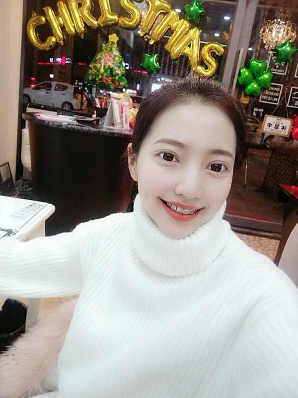 巴中華醫(yī)口腔醫(yī)院做牙齒矯正效果好嗎？附母汶靈醫(yī)生牙齒矯正案例效果圖