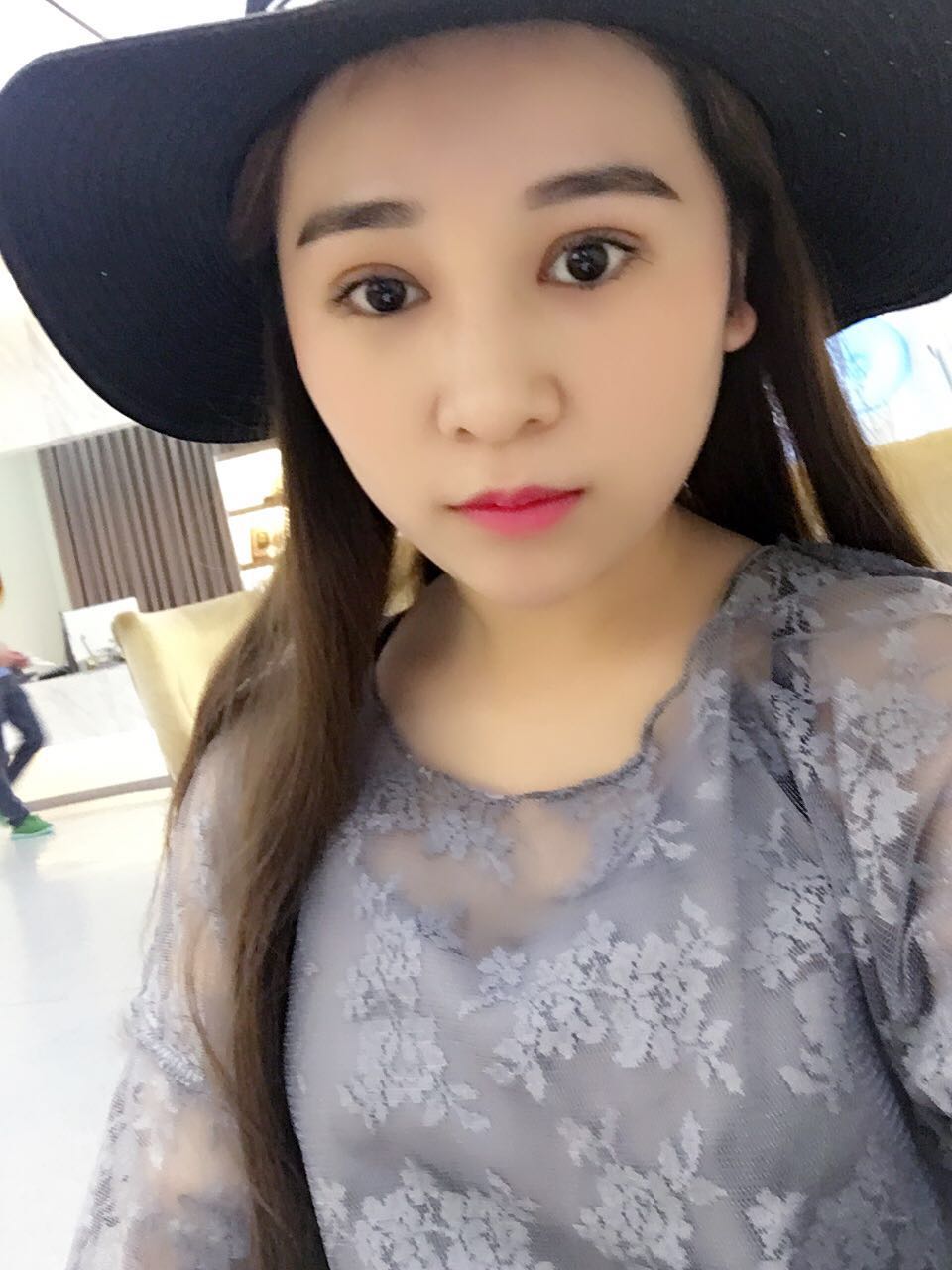 蚌埠韓美美萊整形醫(yī)生鄭捷做開(kāi)眼角怎么樣？附案例效果圖