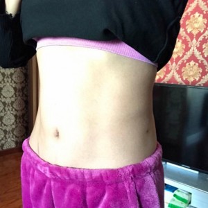 蚌埠韓美美萊整形醫(yī)生張濤做水動(dòng)力吸脂怎么樣？附吸脂案例效果圖