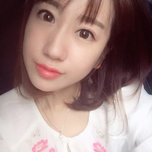 蚌埠韓美美萊整形做玻尿酸面部除皺效果怎么樣？附陳澤醫(yī)生案例效果圖