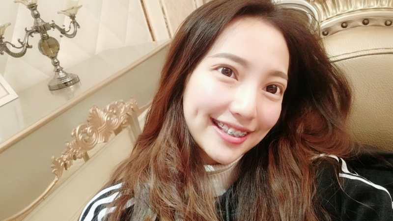 巴中華醫(yī)口腔醫(yī)院做牙齒矯正效果好嗎？附母汶靈醫(yī)生牙齒矯正案例效果圖