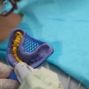 鞍山時代口腔門診部做瓷貼面案例效果圖 鞍山時代口腔門診部做瓷貼面案例效果圖