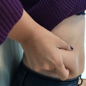 蚌埠韓美美萊整形醫(yī)生張濤做水動(dòng)力吸脂怎么樣？附吸脂案例效果圖