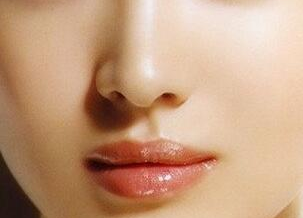 廣州粵秀整形外科醫(yī)院歪鼻矯正