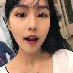 鞍山時(shí)代口腔門診部洗牙效果怎么樣？附申元休醫(yī)生洗牙案例效果圖