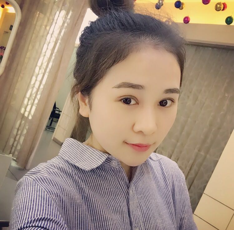 蚌埠韓美美萊整形醫(yī)生鄭捷做開(kāi)眼角怎么樣？附案例效果圖