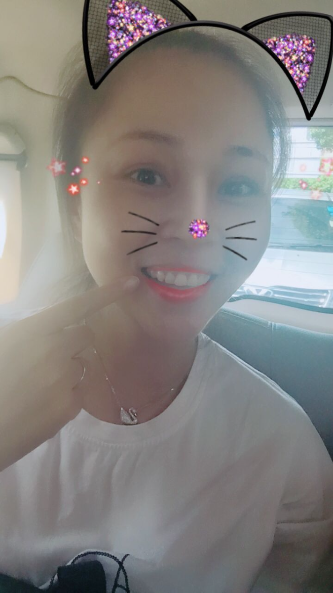 保定東陽(yáng)口腔醫(yī)院趙星醫(yī)生做牙齒瓷貼面怎么樣？附牙齒瓷貼面案例效果對(duì)比圖