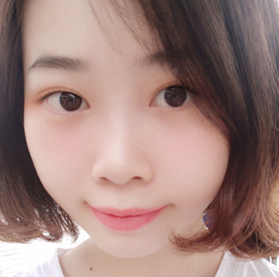 保定安卓貝拉醫(yī)療美容門診部孫大山醫(yī)生做雙眼皮+去眼袋怎么樣？附案例效果對比圖