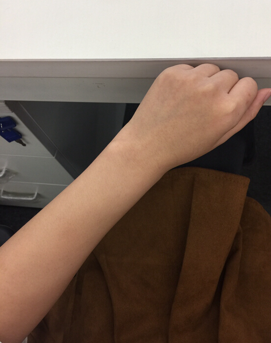 蚌埠市第三人民醫(yī)院燒傷整形科李方奇注射美白針效果怎么樣？安全嗎？附案例