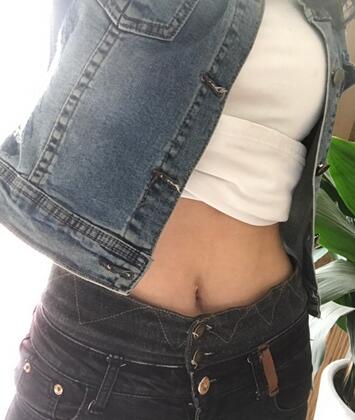 保定現代女子醫(yī)院整形美容中心做腰腹部吸脂怎么樣？附林秀蓮醫(yī)生案例效果圖