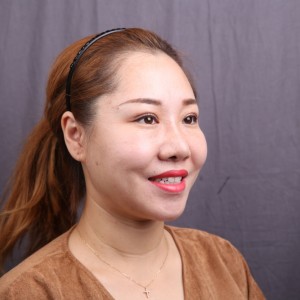 保定東陽(yáng)口腔醫(yī)院趙晨醫(yī)生做瓷貼面怎么樣?附瓷貼面案例效果對(duì)比圖 保定東陽(yáng)口腔醫(yī)院趙晨醫(yī)生做瓷貼面怎么樣?附瓷貼面案例效果對(duì)比圖