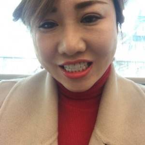 保定東陽(yáng)口腔醫(yī)院趙晨醫(yī)生做瓷貼面怎么樣?附瓷貼面案例效果對(duì)比圖 保定東陽(yáng)口腔醫(yī)院趙晨醫(yī)生做瓷貼面怎么樣?附瓷貼面案例效果對(duì)比圖