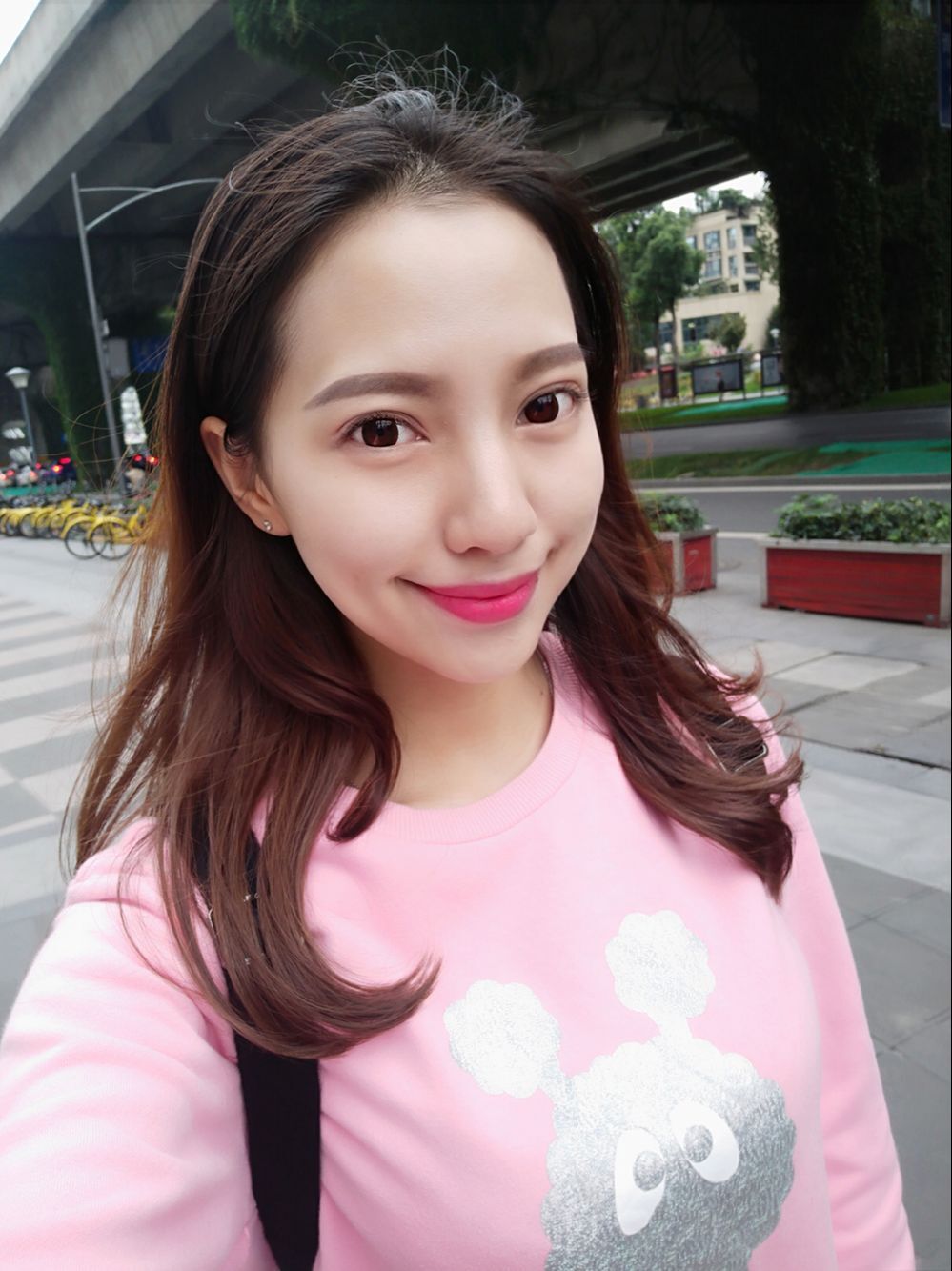 保定東陽口腔醫(yī)院溫興醫(yī)生做牙齒矯正怎么樣？附牙齒矯正案例效果對(duì)比圖