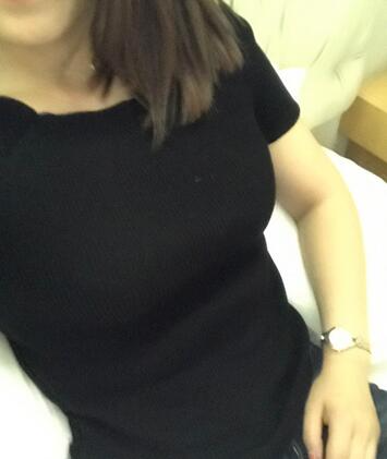 保定現(xiàn)代女子醫(yī)院整形美容中心做腰腹部吸脂怎么樣？附林秀蓮醫(yī)生案例效果圖