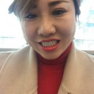 保定東陽口腔醫(yī)院趙晨醫(yī)生做瓷貼面怎么樣？附瓷貼面案例效果對比圖