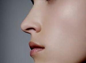 長(zhǎng)沙雅美醫(yī)療美容醫(yī)院鼻翼縮小
