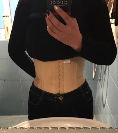 保定現代女子醫(yī)院整形美容中心做腰腹部吸脂怎么樣？附林秀蓮醫(yī)生案例效果圖