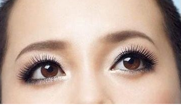 激光去黑眼圈多少錢？激光去黑眼圈效果好嗎？