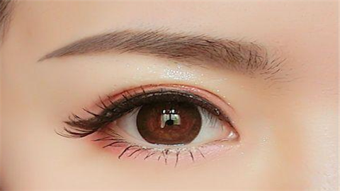 雙眼皮埋線是什么線？