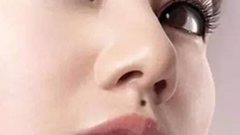 綜合隆鼻價格需要多少錢？價格貴嗎？