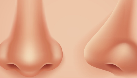 鼻頭縮小手術(shù)風(fēng)險大嗎？