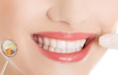 美容冠的危害有哪些？可以矯正齙牙嗎？