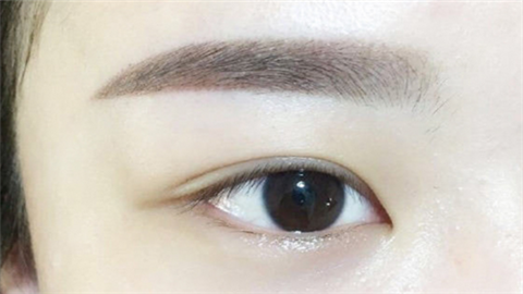 種植眉毛要多少錢(qián)？