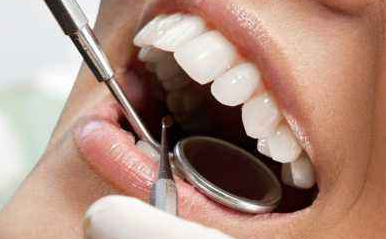 超聲波洗牙一次多少錢？價(jià)錢怎么樣？