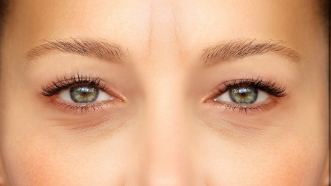 吸脂去眼袋效果好嗎？