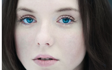 激光點(diǎn)痣留下的疤痕怎么辦？