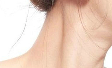 頸紋太深怎么辦?去除頸紋一般需要多少錢？