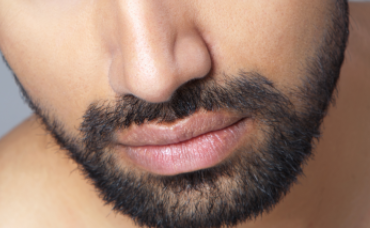 激光脫胡子多久脫一次？激光去胡子大概多少錢一次？