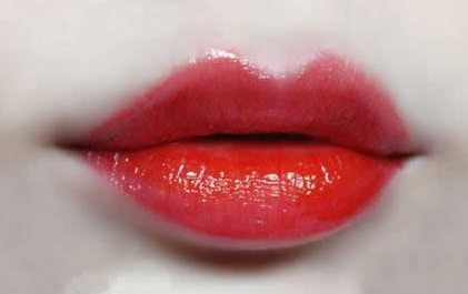 M唇整形效果怎么樣？術(shù)后多久能恢復(fù)？