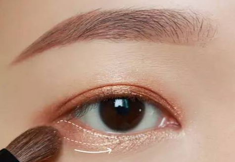 全切雙眼皮術(shù)后多久拆線？