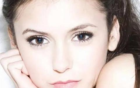 全切雙眼皮會(huì)留疤嗎？全切雙眼皮的優(yōu)勢(shì)有哪些？