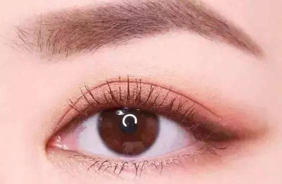 全切雙眼皮有什么副作用？