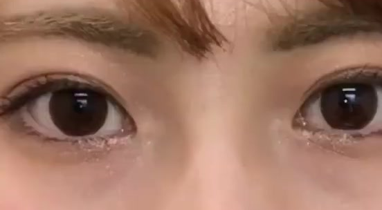 雙眼皮埋線后還可以開眼角嗎？做埋線雙眼皮有什么危險(xiǎn)？