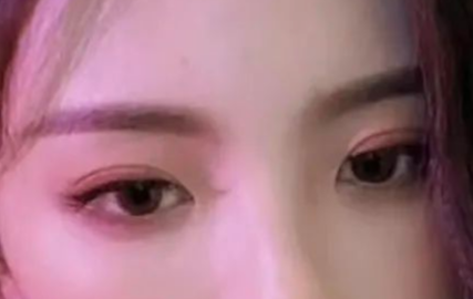 割雙眼皮會有疤痕嗎？