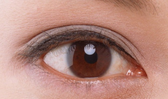 韓式開眼角安全嗎？