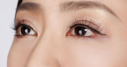 韓式開眼角需要多久?韓式無痕開眼角需要多少錢？