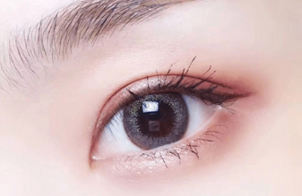 開內(nèi)眼角大概需要多久恢復(fù)？