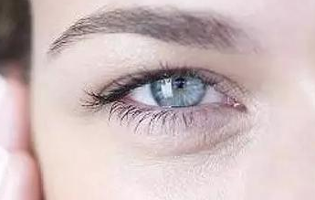 開內(nèi)眼角的弊端有哪些？