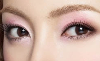 開內(nèi)眼角疤痕怎么消除？開內(nèi)眼角能保持多久？