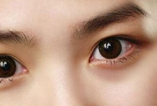 開眼角多少錢才不貴呢？開眼角多少天才能好？