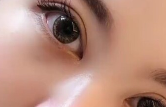 開眼角有沒有風(fēng)險(xiǎn)？開眼角有沒有副作用？