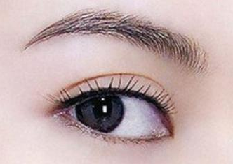 開眼角手術(shù)腫嗎？