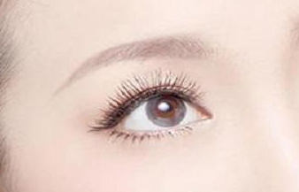 開眼角術(shù)的恢復(fù)期是多久？開眼角術(shù)的注意事項有哪些？