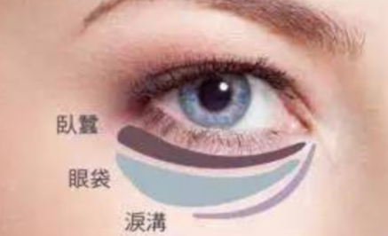 激光能祛除眼袋嗎？